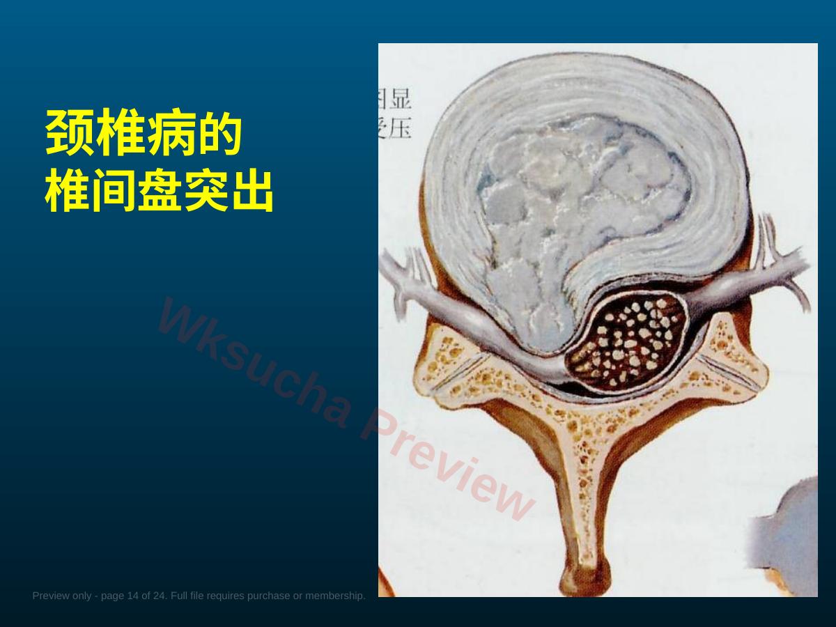 预览第 14 页
