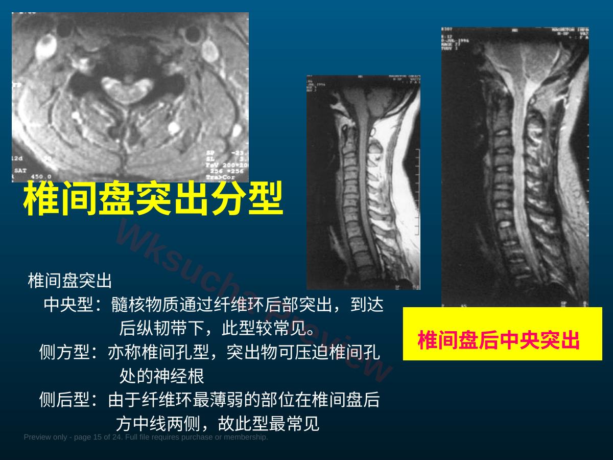 预览第 15 页