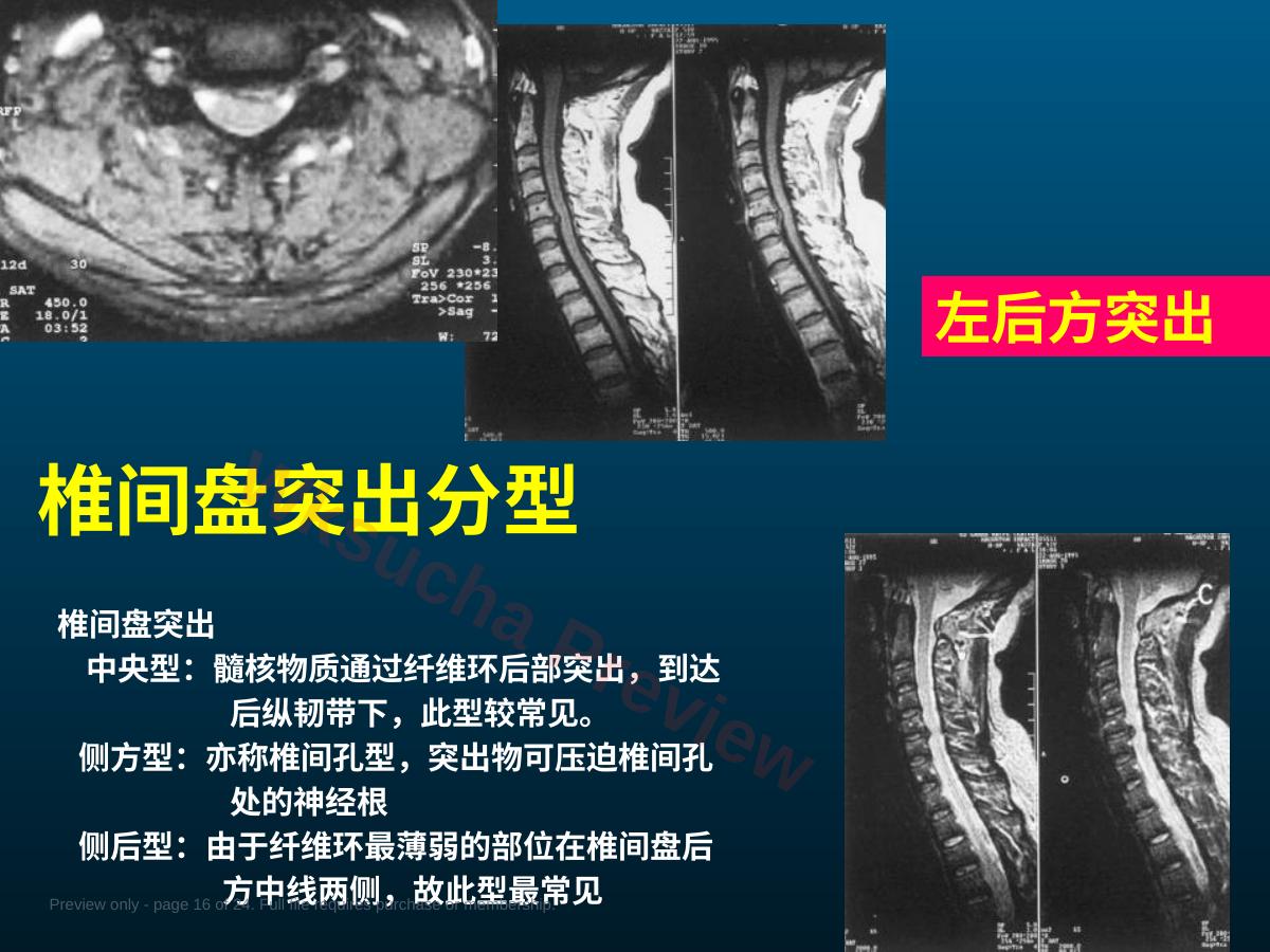 预览第 16 页