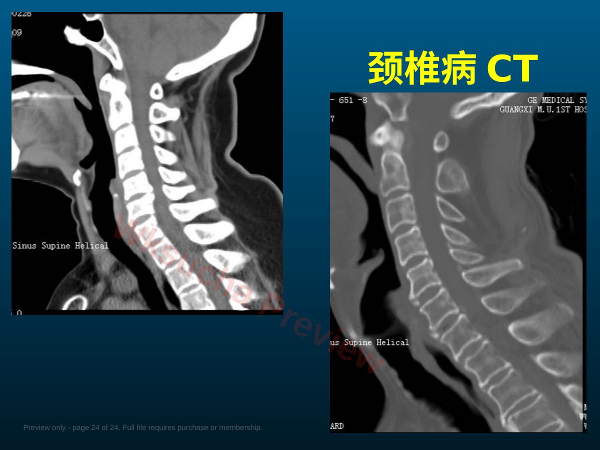 预览第 24 页