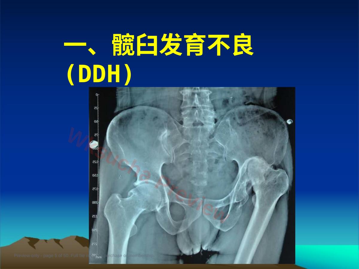 预览第 5 页