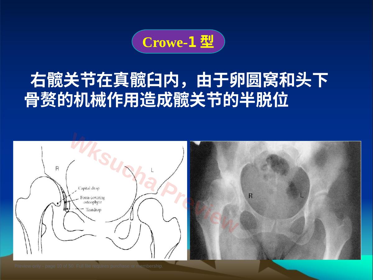 预览第 10 页