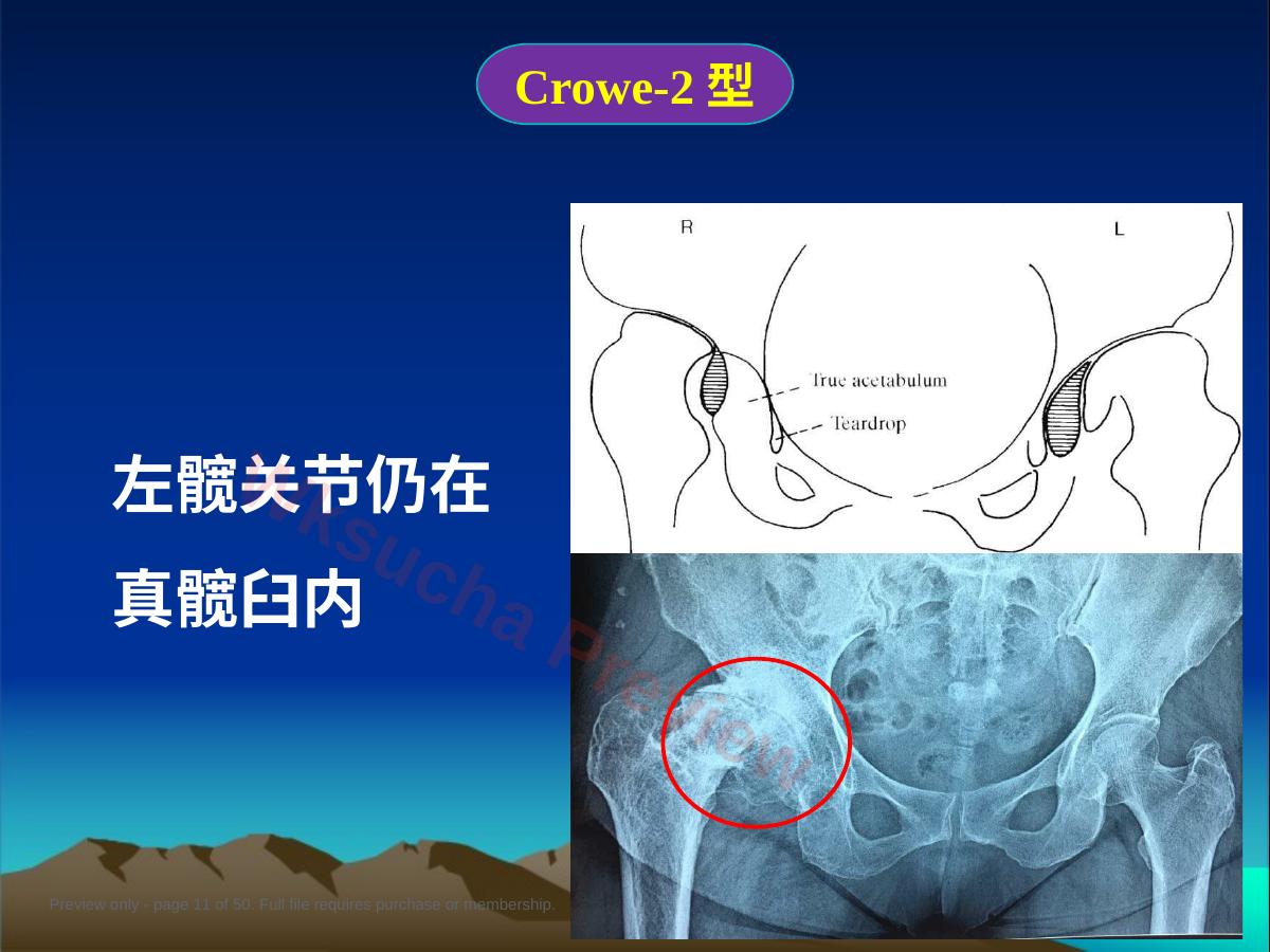 预览第 11 页