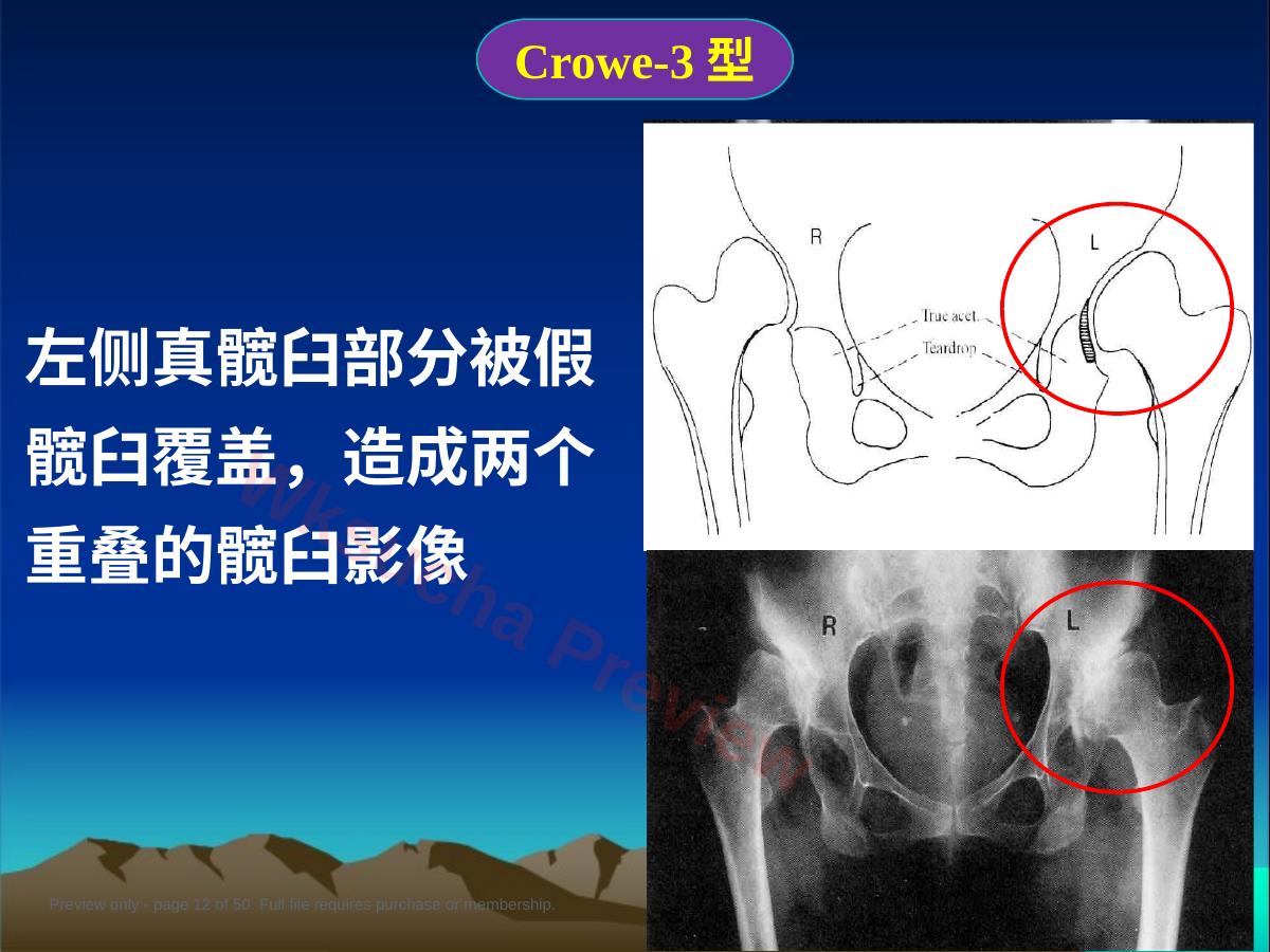 预览第 12 页