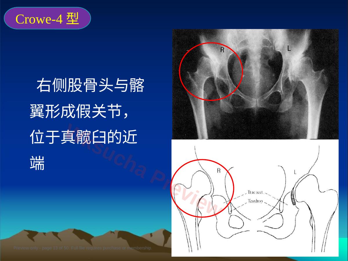 预览第 13 页