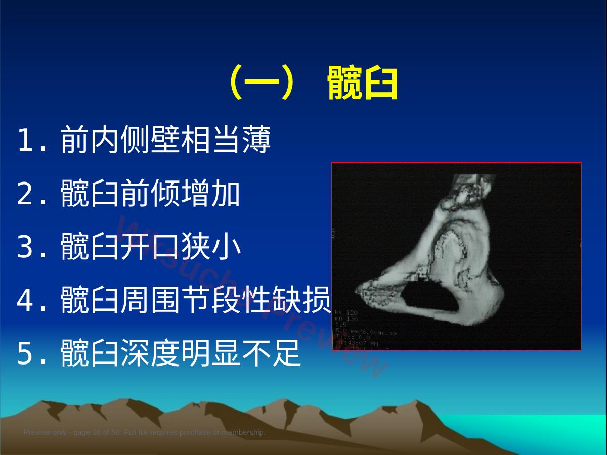 预览第 16 页