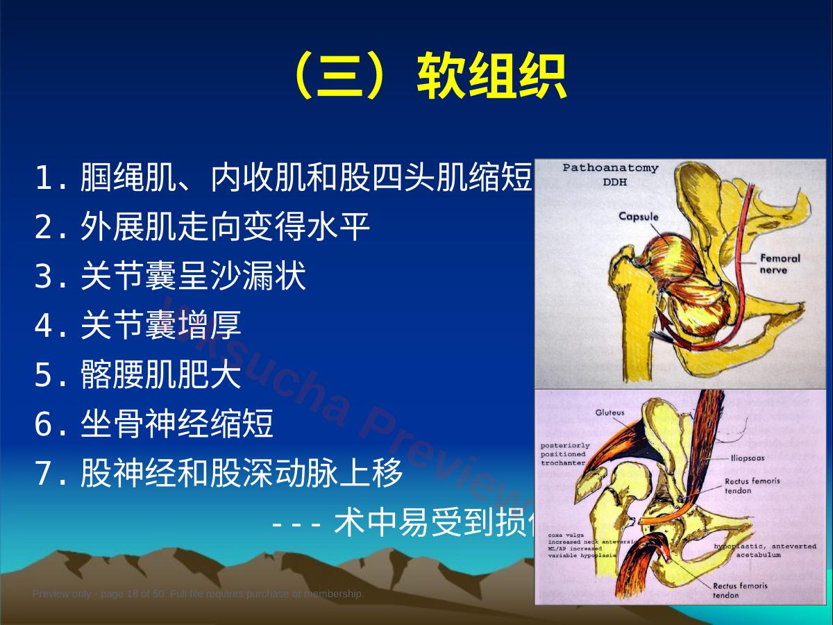 预览第 18 页