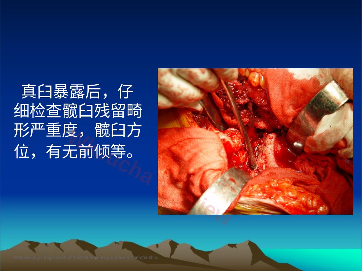 预览第 33 页