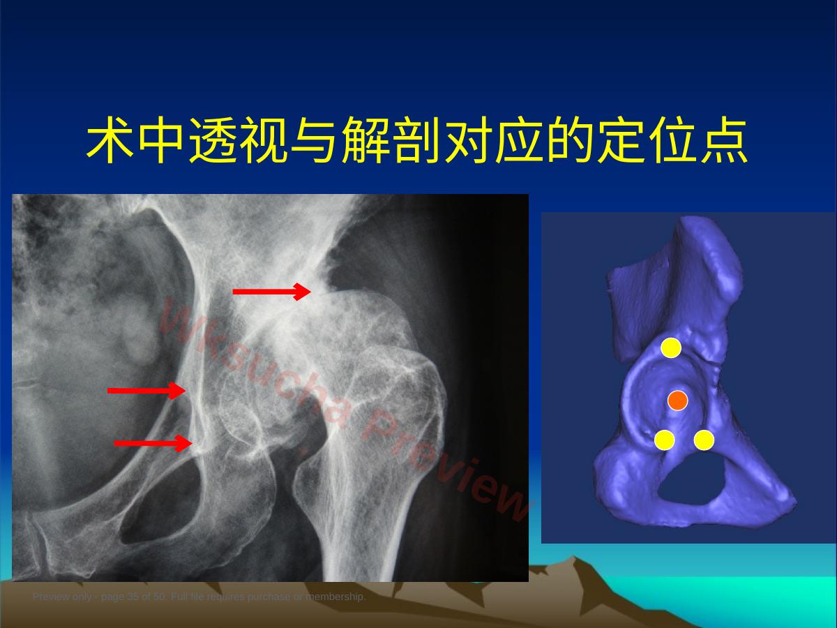 预览第 35 页