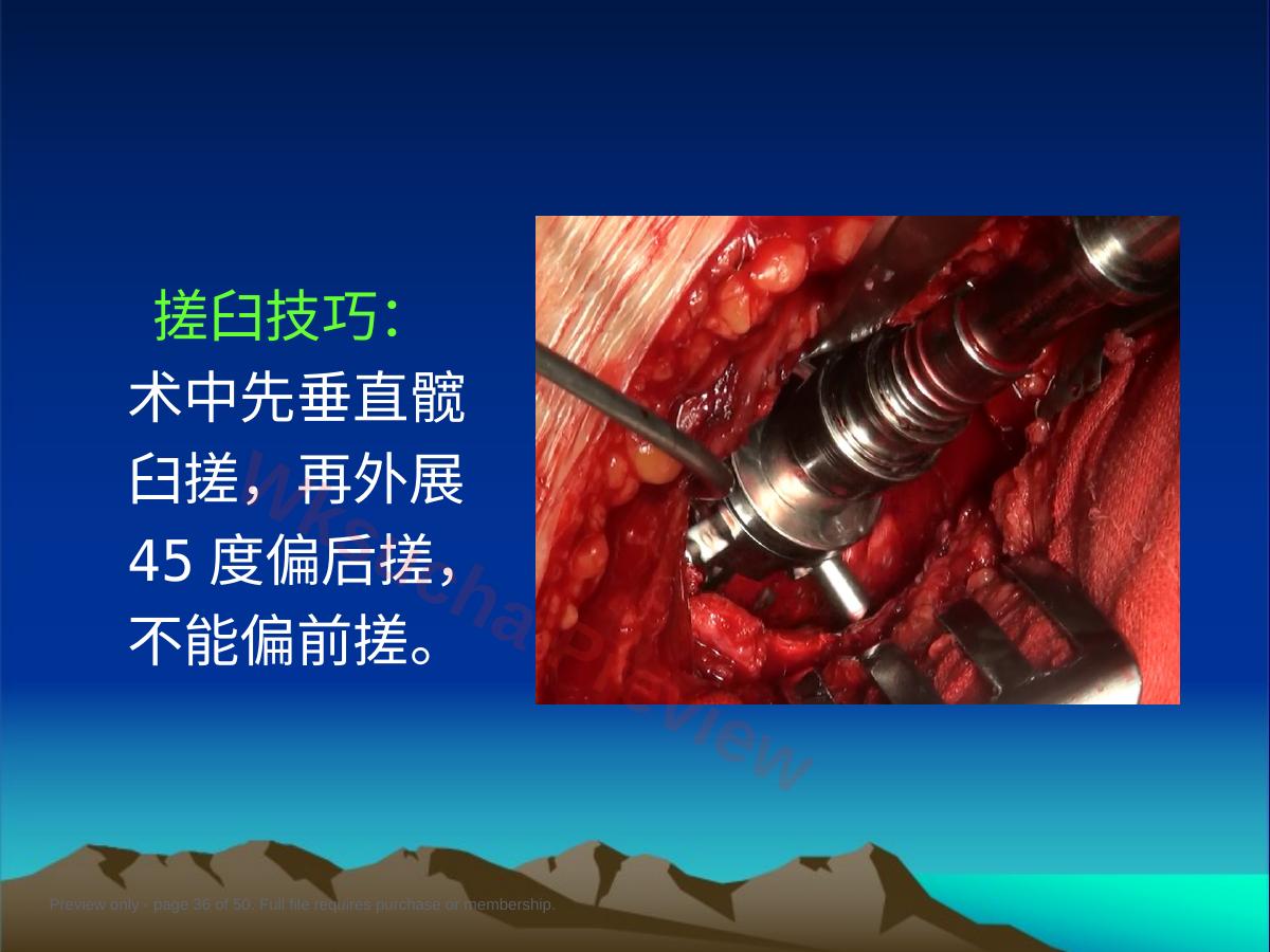 预览第 36 页