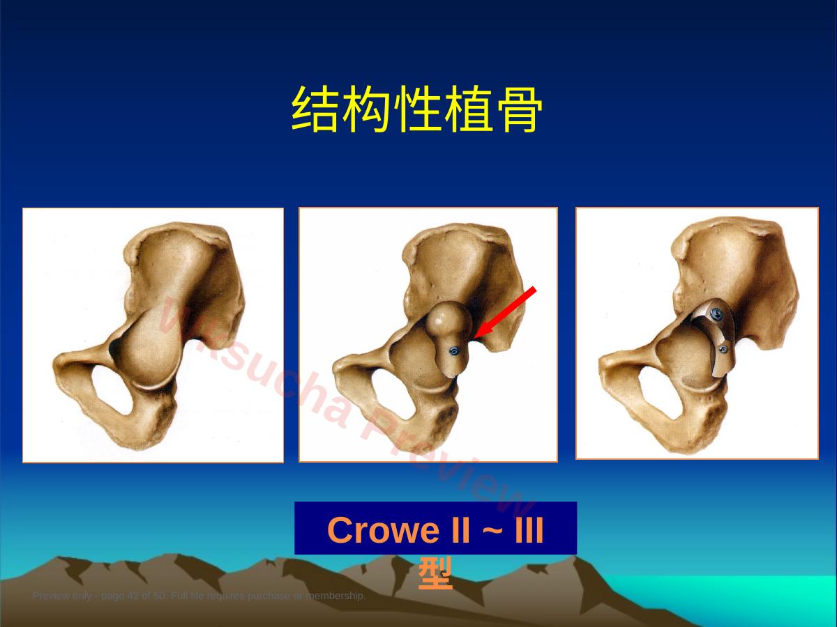 预览第 42 页