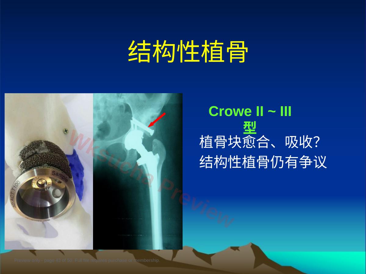 预览第 43 页