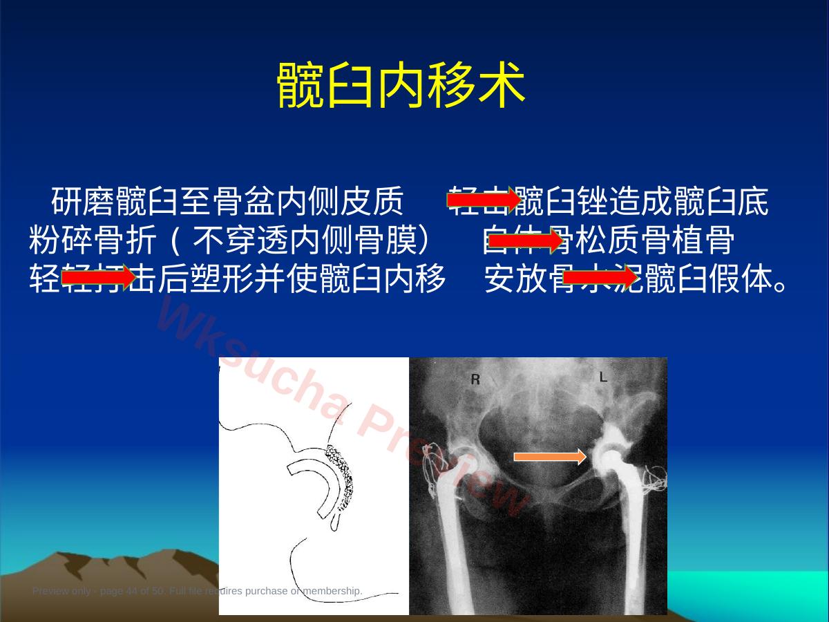 预览第 44 页