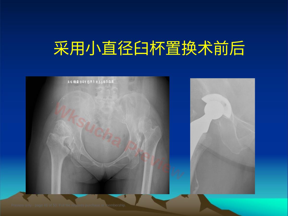 预览第 46 页