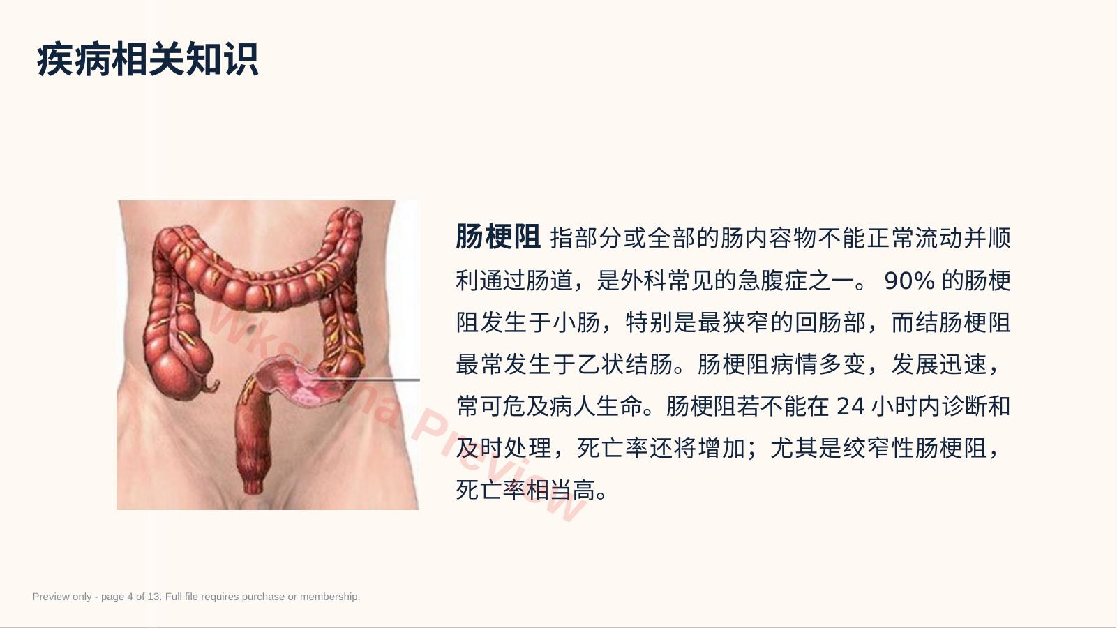 预览第 4 页