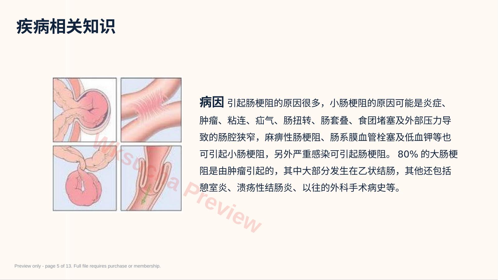 预览第 5 页