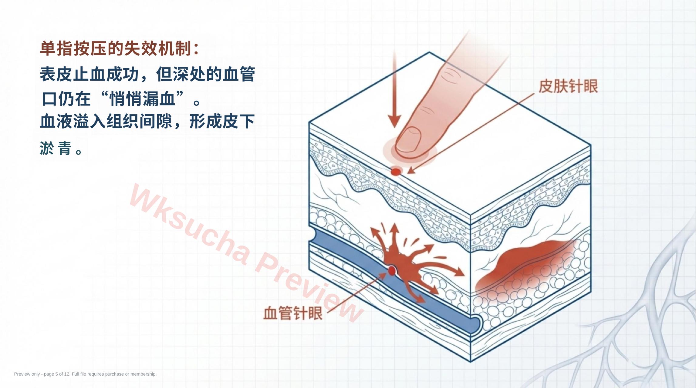 预览第 5 页