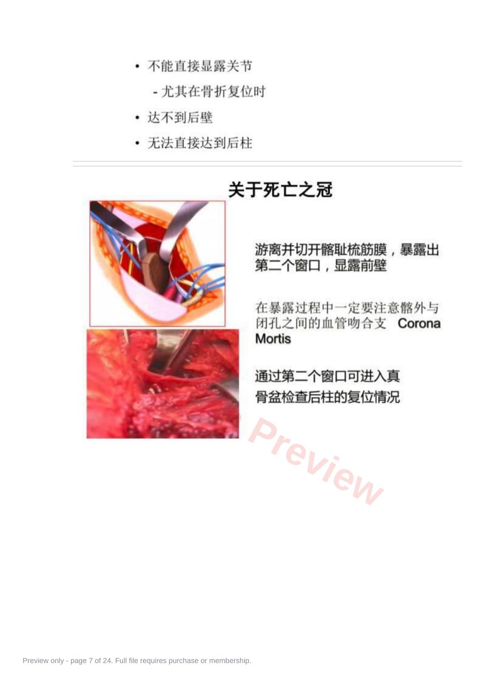 预览第 7 页