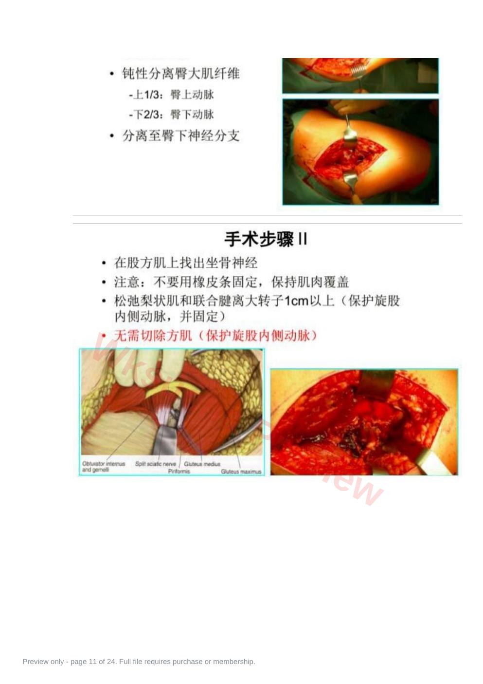 预览第 11 页