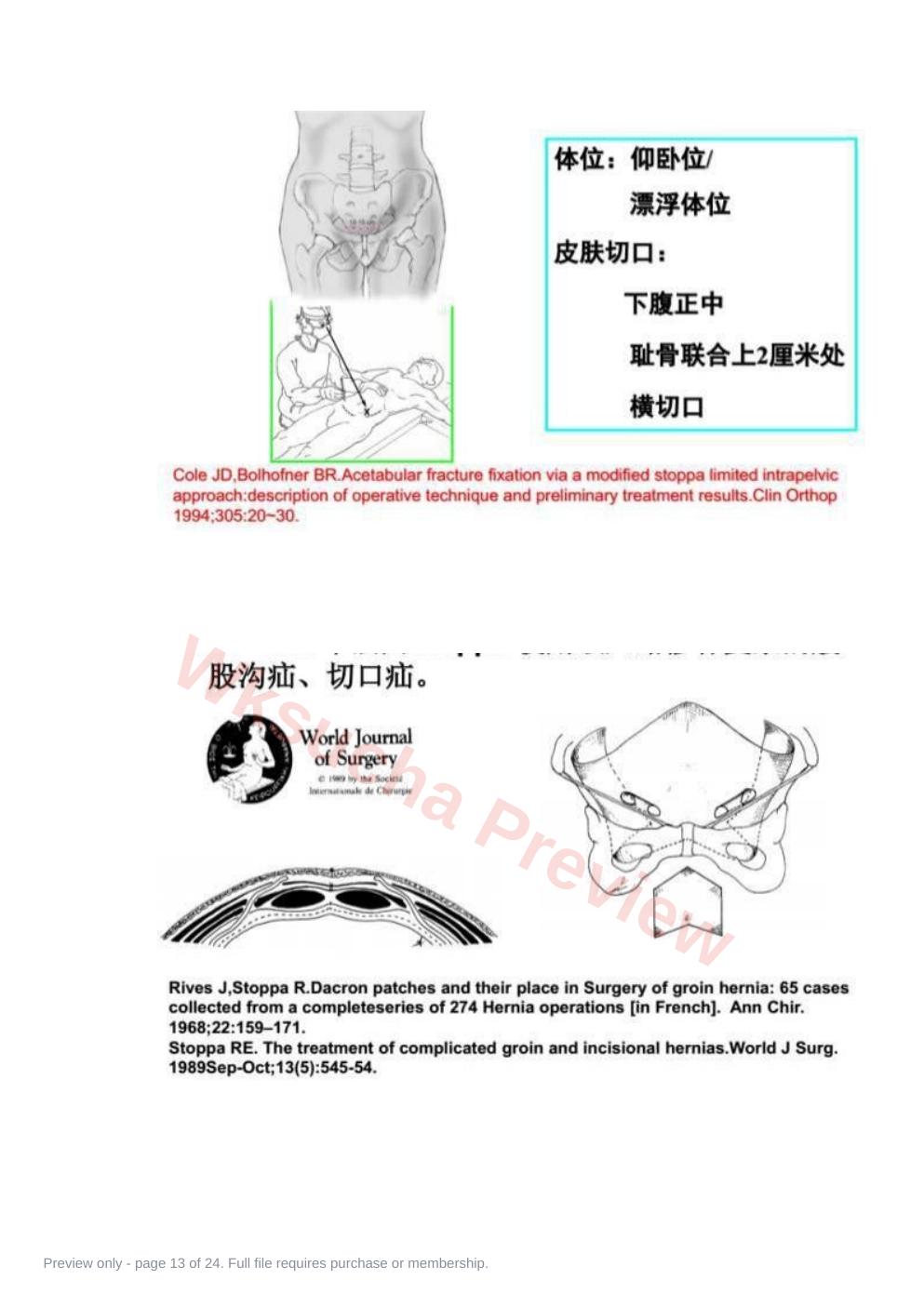 预览第 13 页
