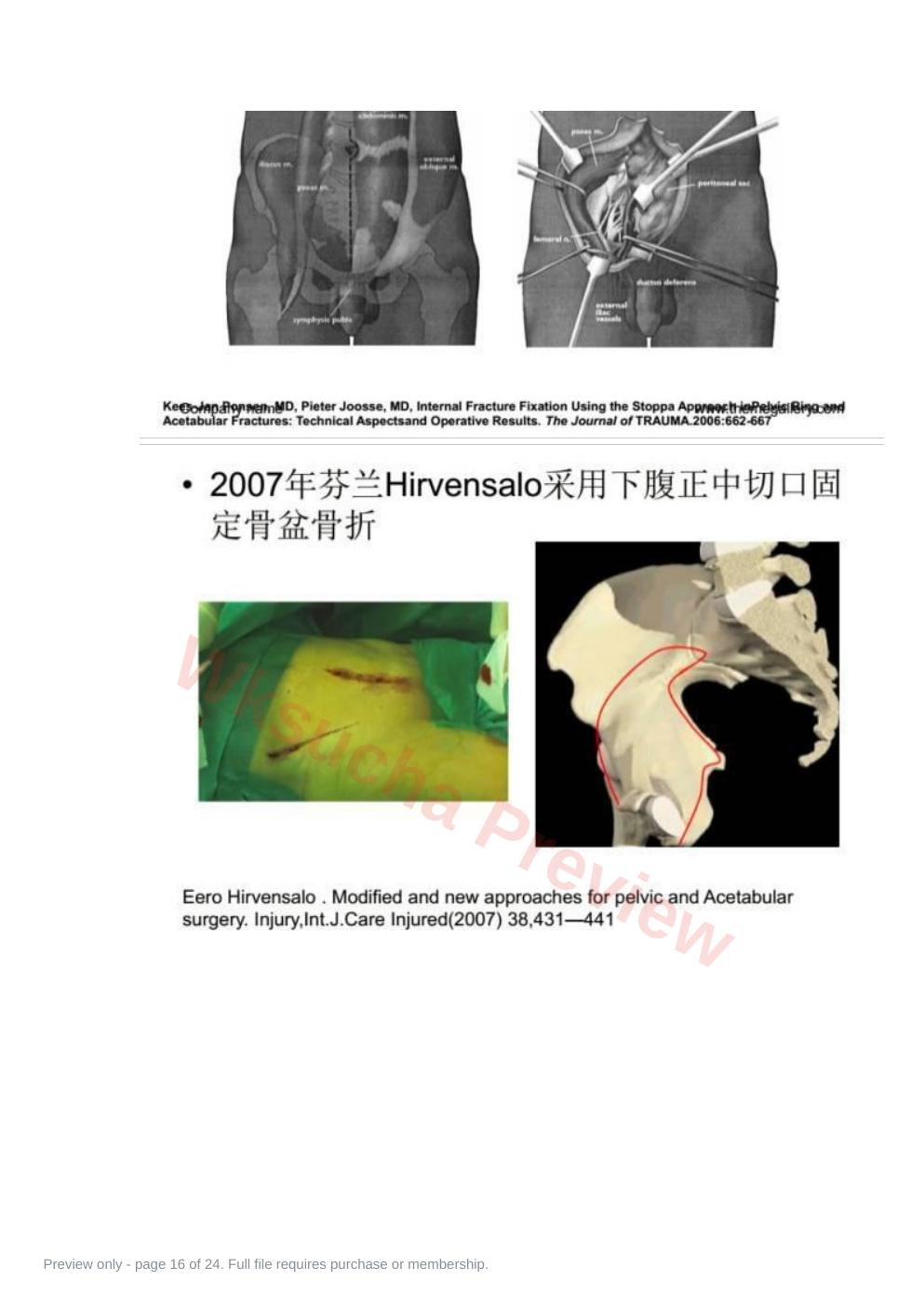预览第 16 页