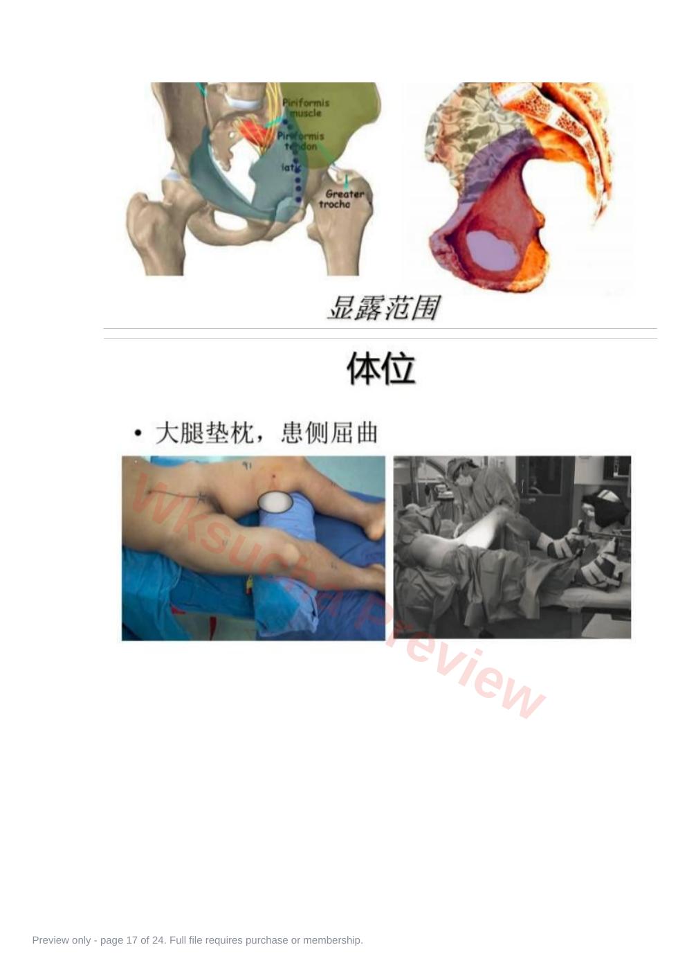 预览第 17 页