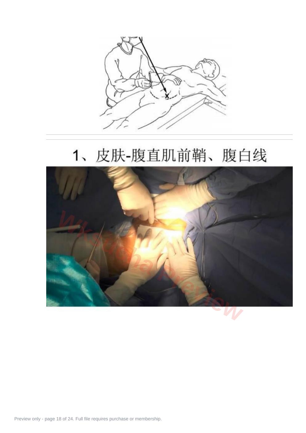 预览第 18 页