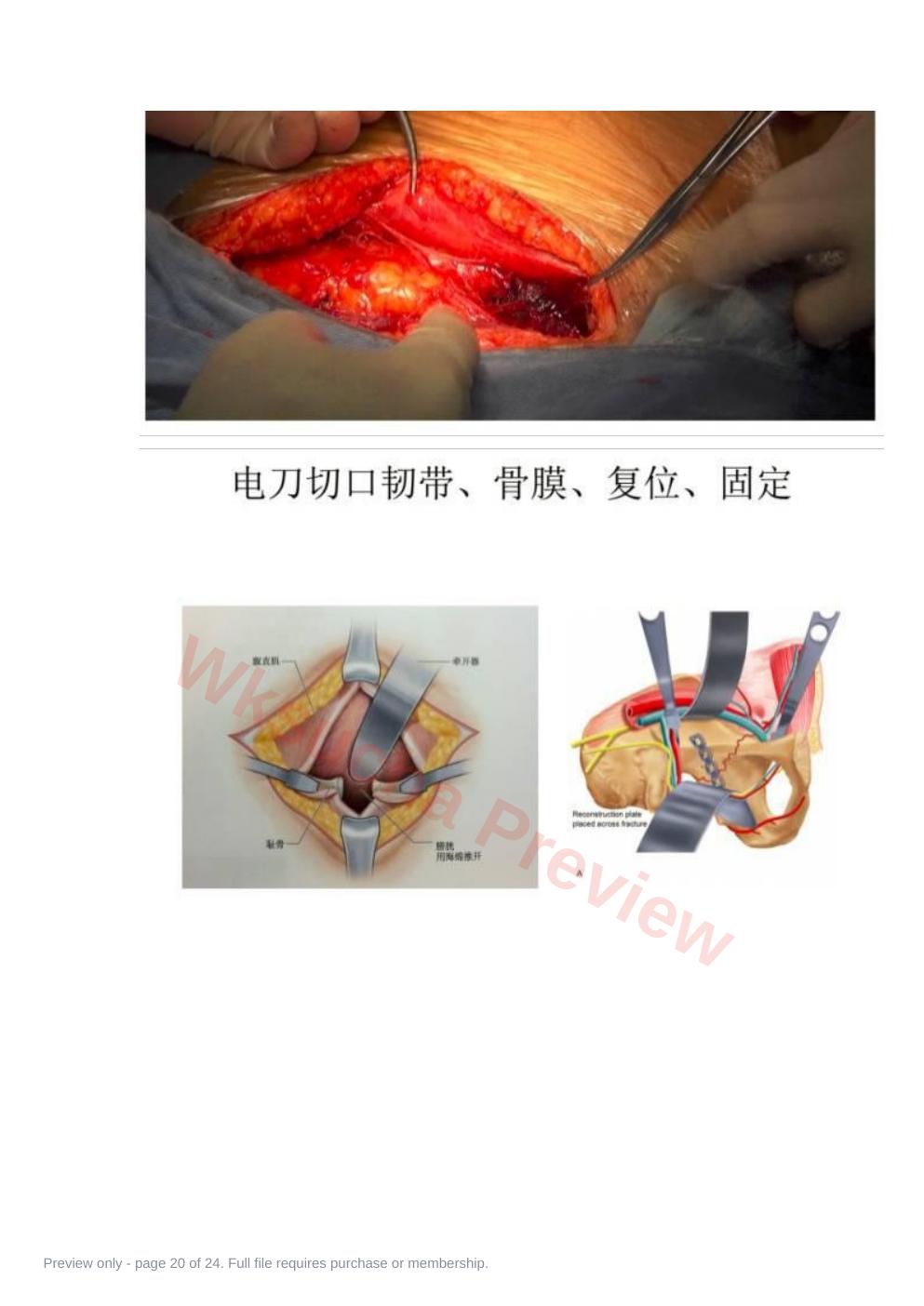 预览第 20 页