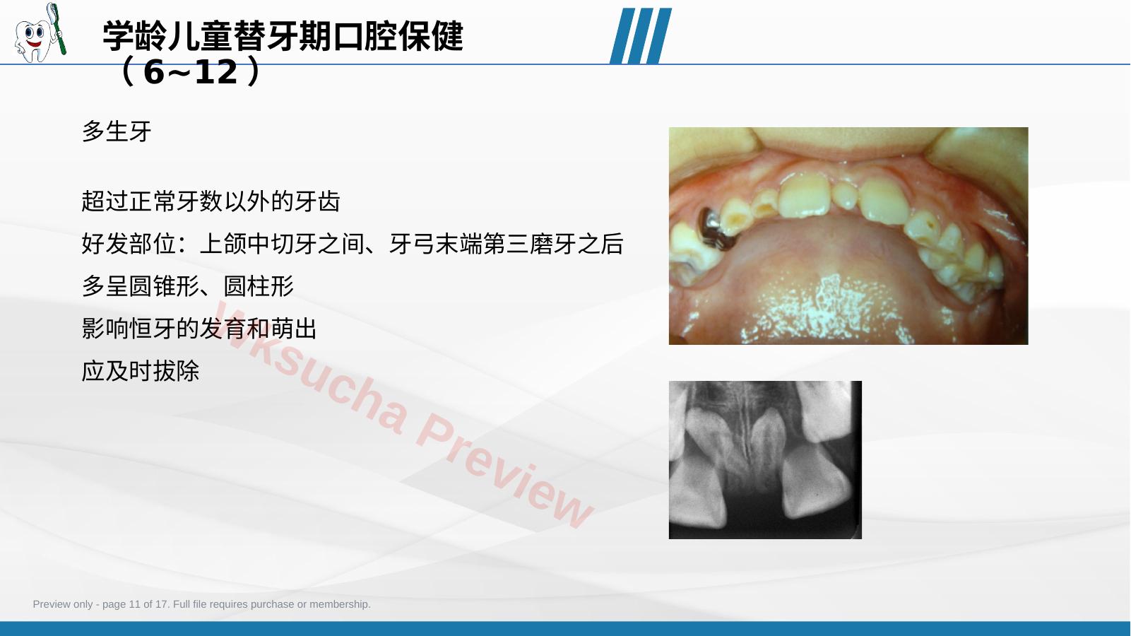 预览第 11 页
