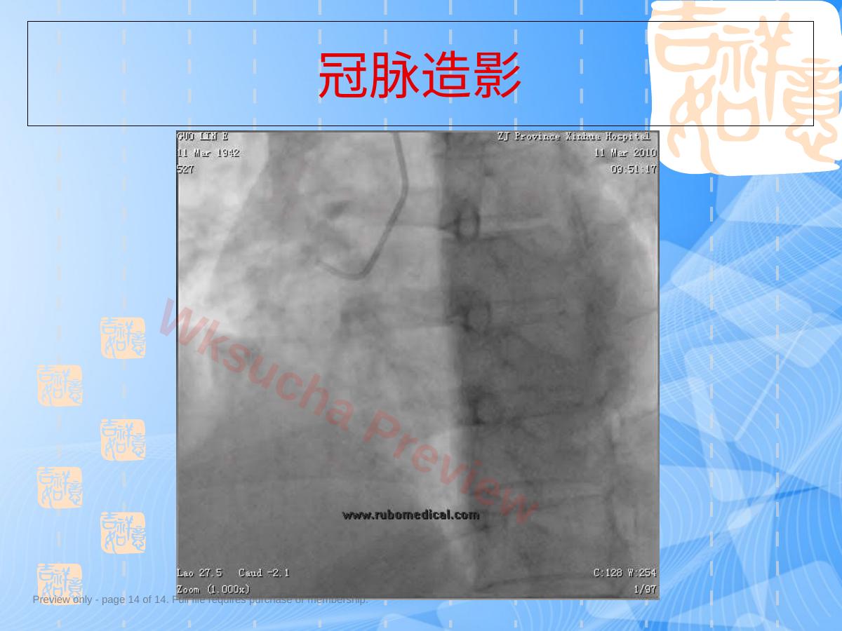 预览第 14 页