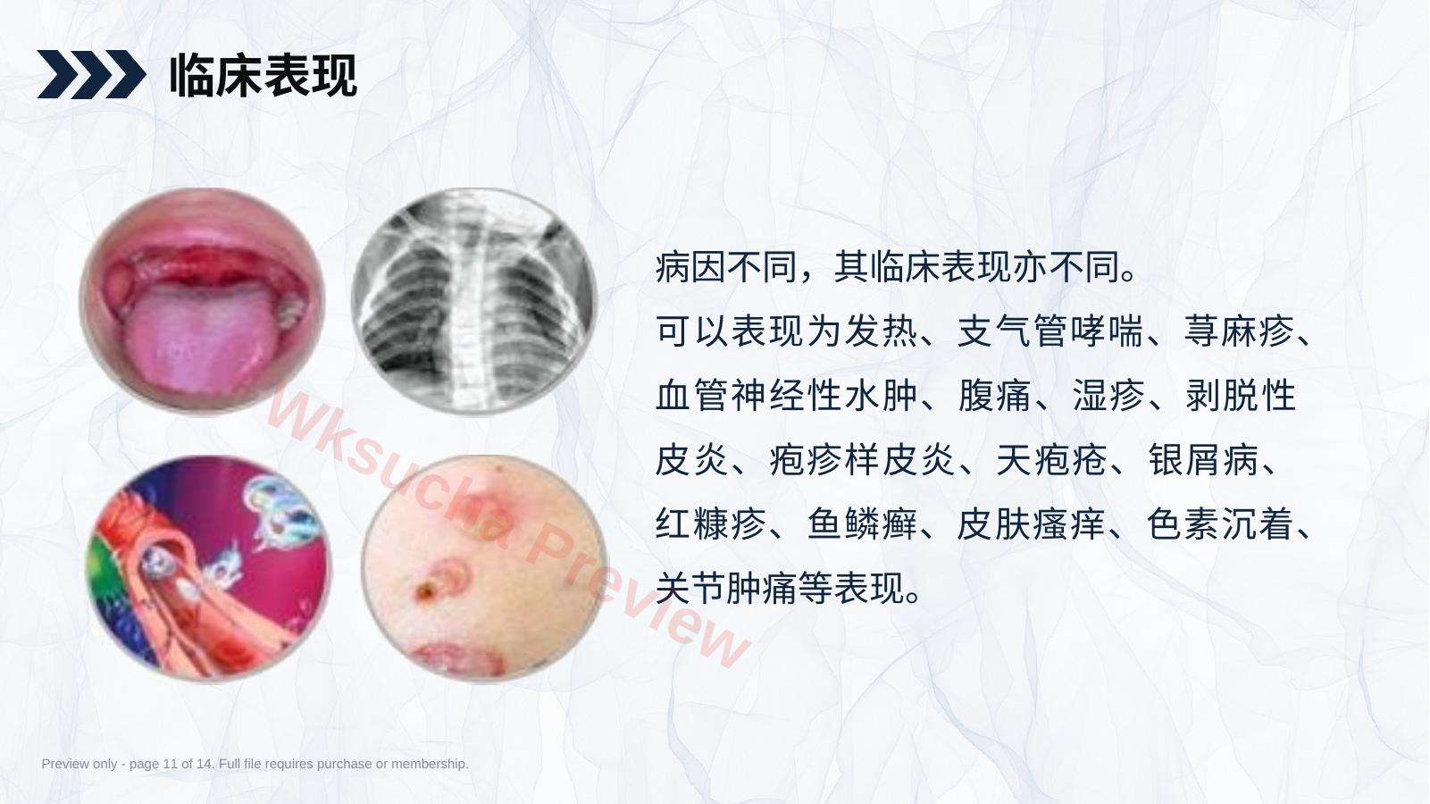 预览第 11 页