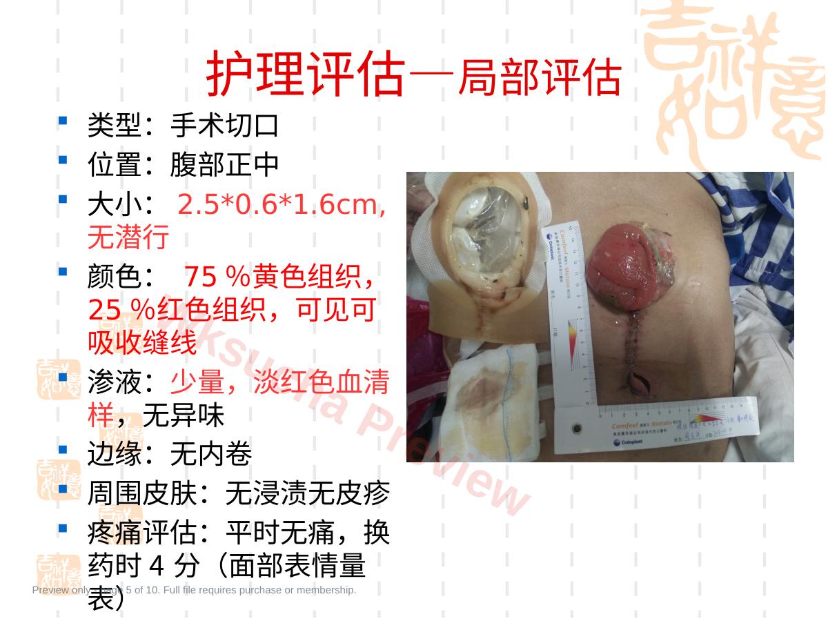预览第 5 页