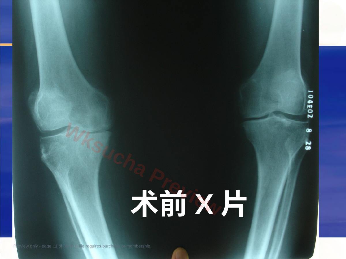 预览第 11 页