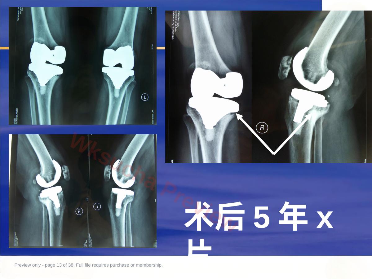 预览第 13 页