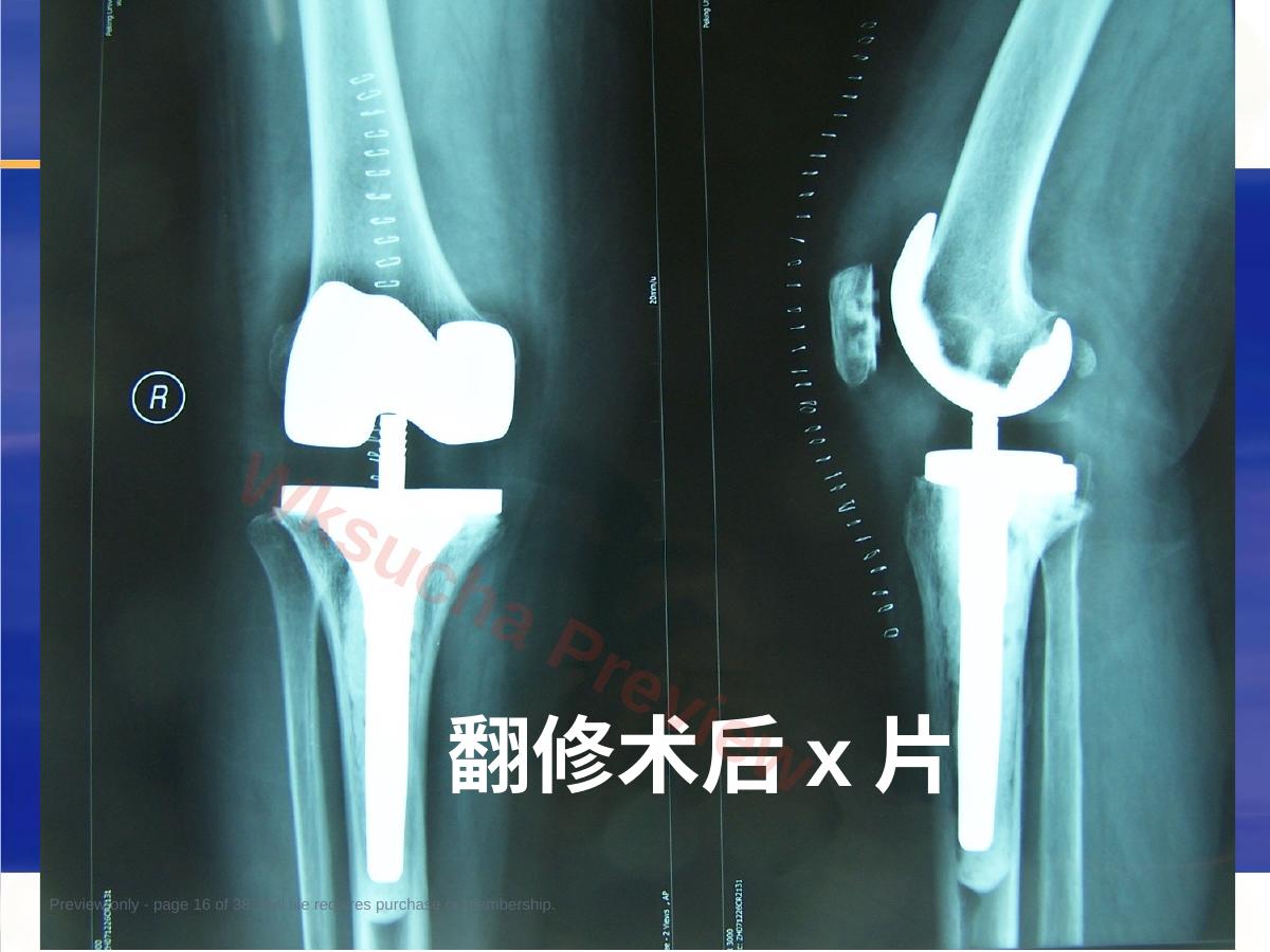 预览第 16 页