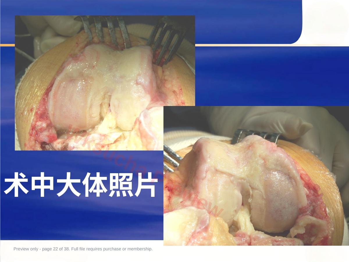预览第 22 页