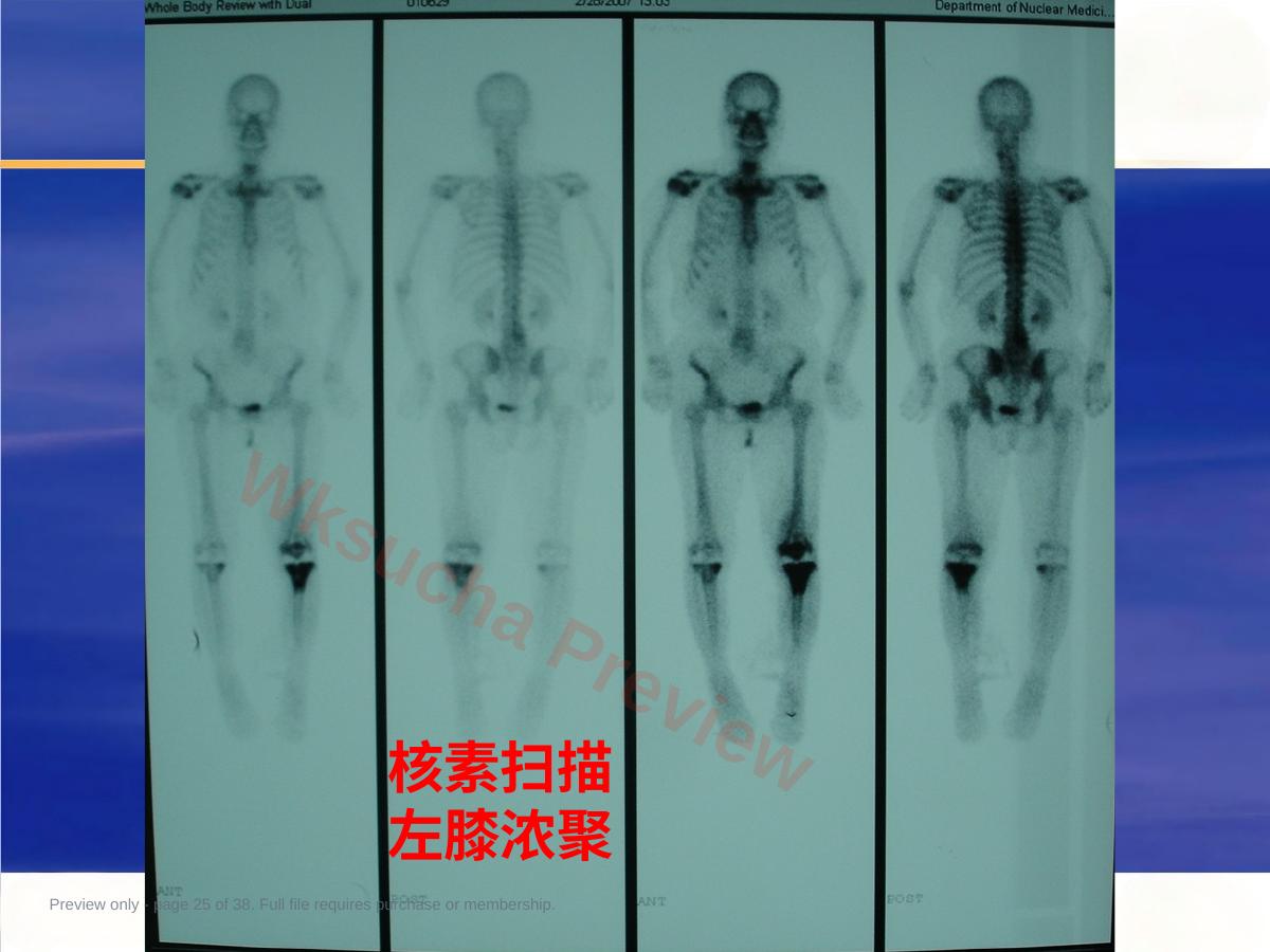 预览第 25 页