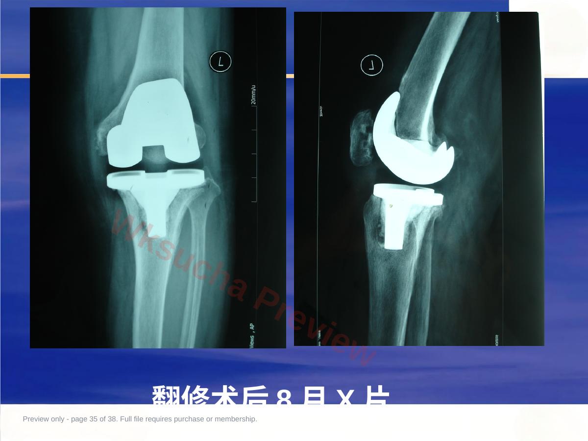 预览第 35 页