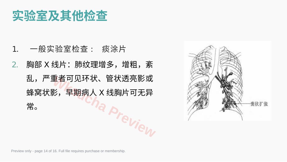 预览第 14 页