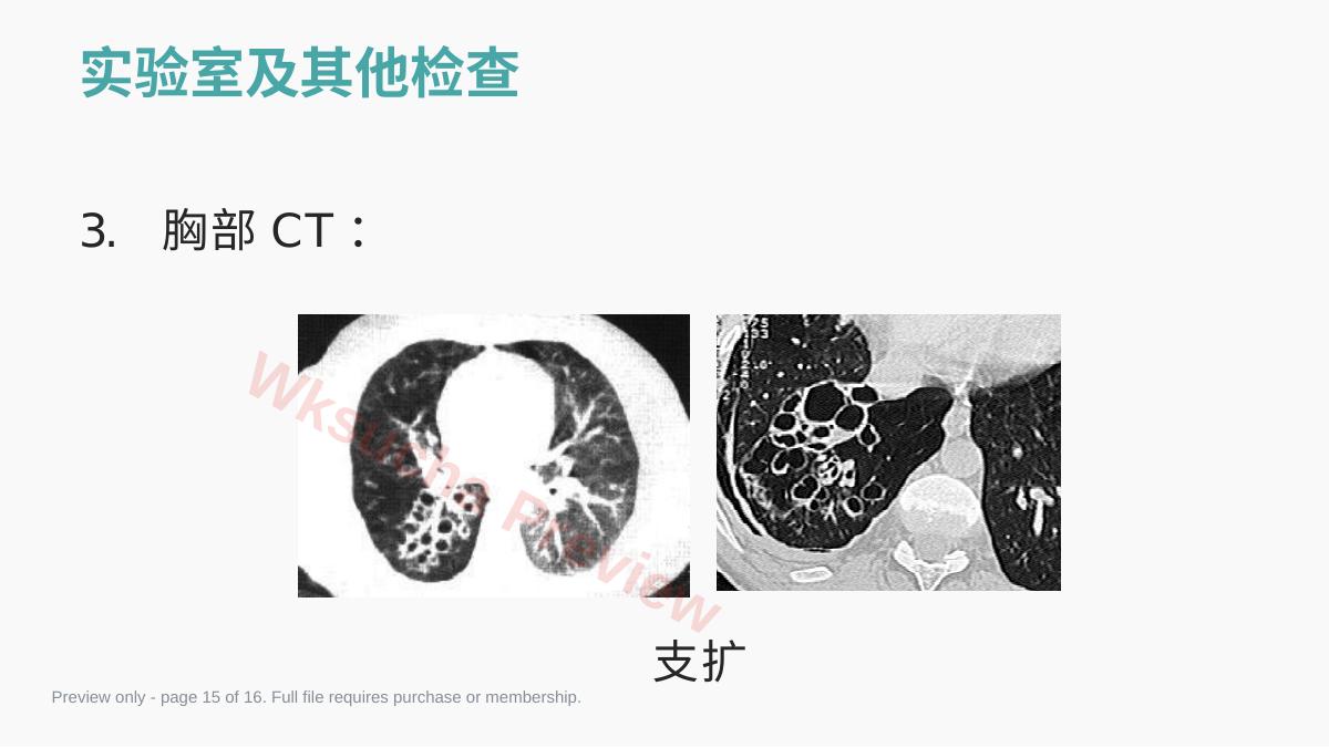 预览第 15 页