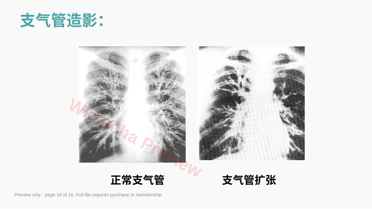 预览第 16 页