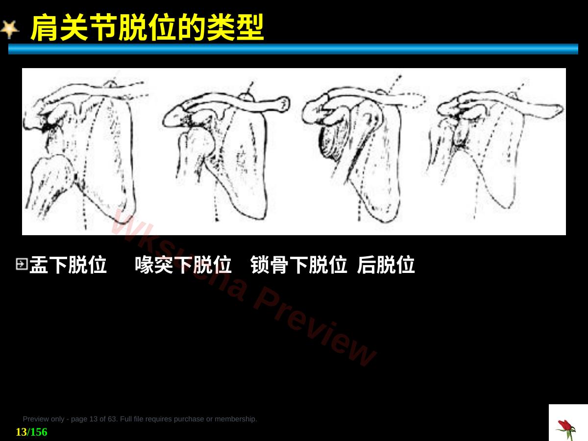 预览第 13 页