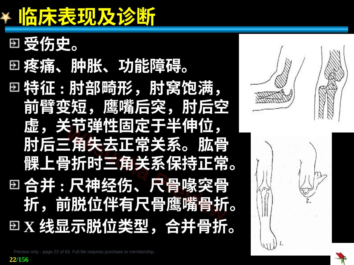预览第 22 页