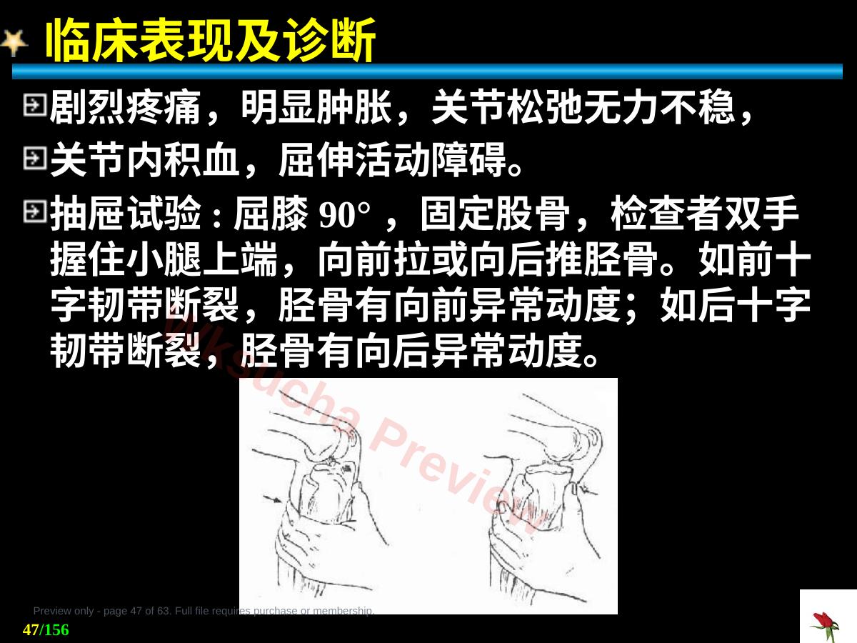预览第 47 页