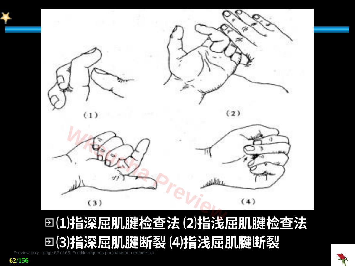 预览第 62 页