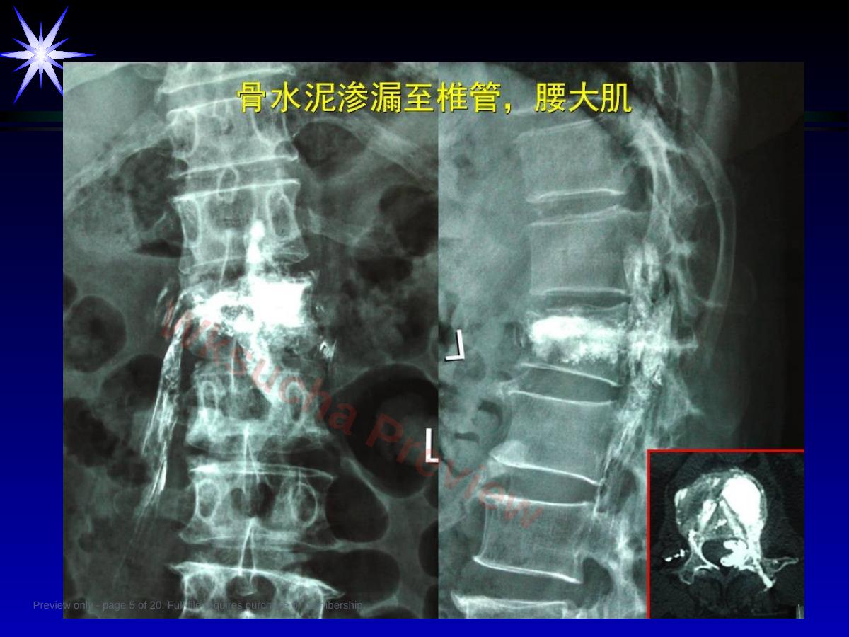 预览第 5 页