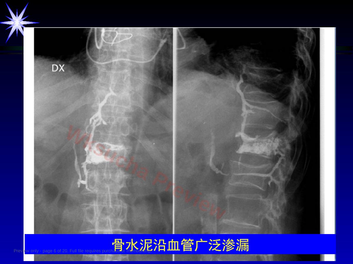 预览第 6 页