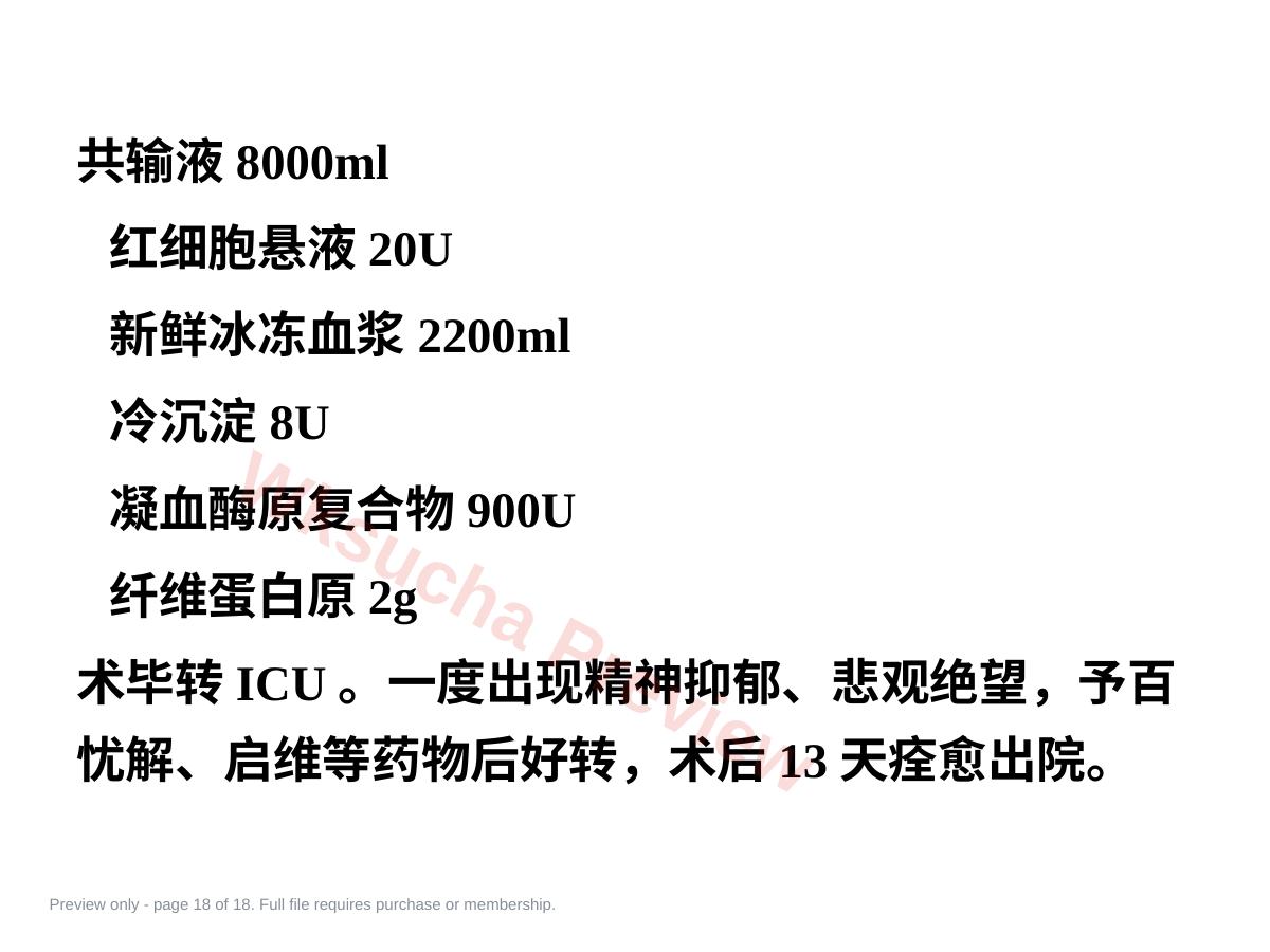 预览第 18 页
