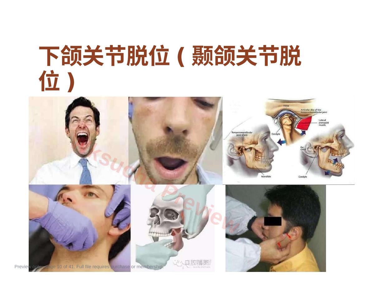 预览第 10 页
