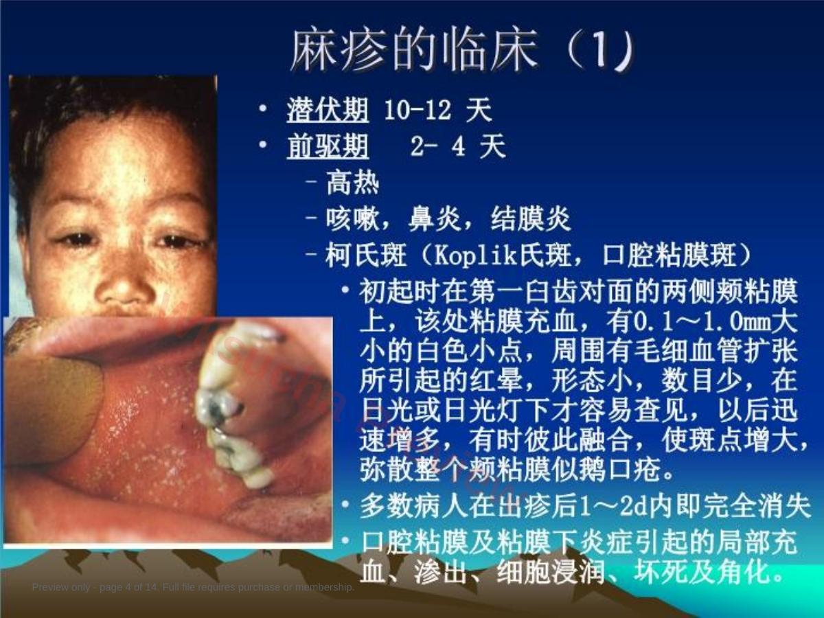 预览第 4 页